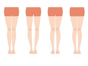 下半身痩せダイエットとo脚x脚のイラスト